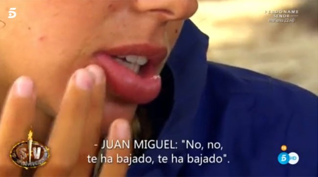 Este es el aspecto que tiene el labio de Laura Matamoros tras la picadura.