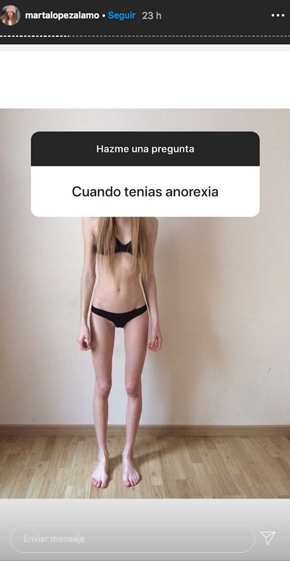 marta-lopez-anorexia